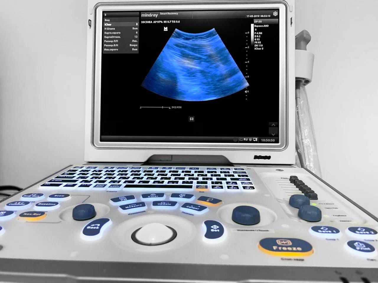 УЗИ-диагностика для спортсменов в клинике Смарт Рекавери